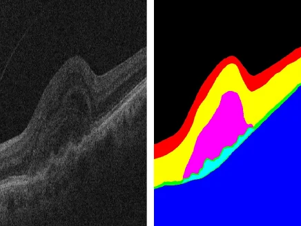 Retinal OCT scan next to its colour-coded layer segmentation mask